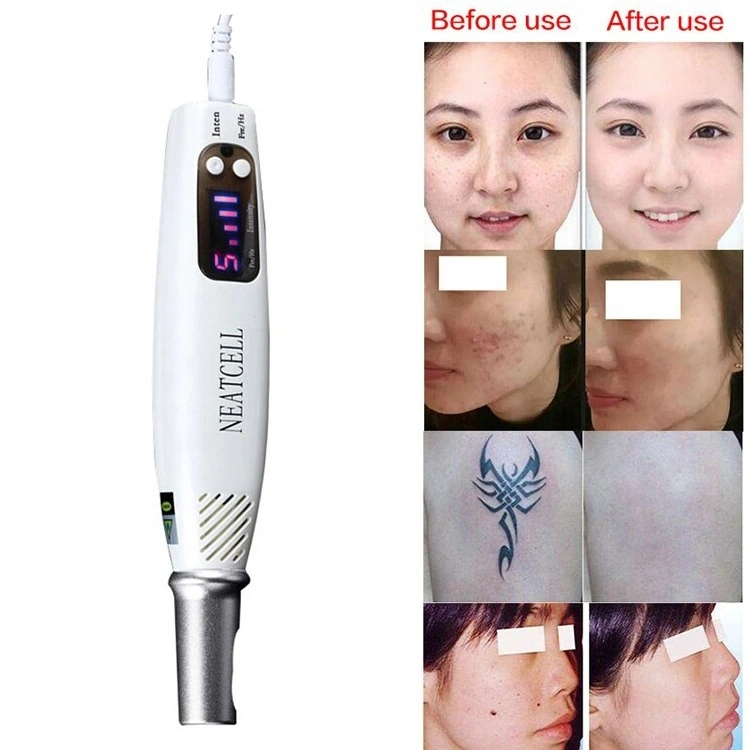 Portable Picosecond Laser Tattoo Removal Freckle Removal Spot Removal Pen