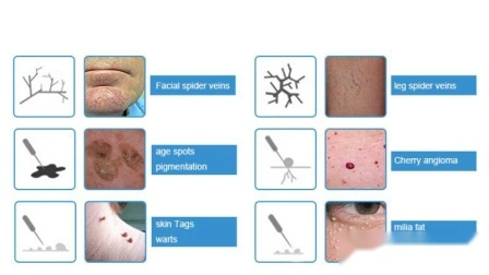 Sistema de terapia de varizes Ce multiuso portátil RF máquina facial galvânica para remoção de verrugas vasculares de alta frequência