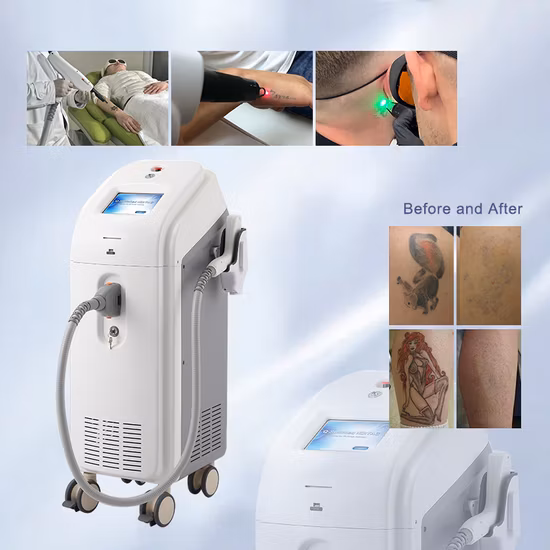 Laser Q Switch para remoção de tatuagem ND YAG e também para remoção de verrugas