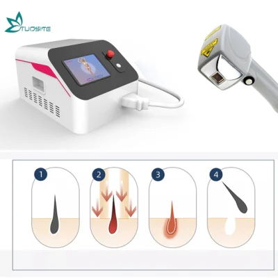 Máquina de Laser de Picosegundo Portátil Equipamento de Remoção de Tatuagem Dispositivo Comutado de Peeling a Laser de Carbono